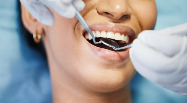 Best Urgent Care for Lost Fillings or Crowns in India Hook, SC