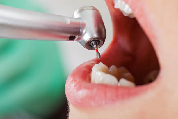 Best Emergency Gum Treatment in India Hook, SC